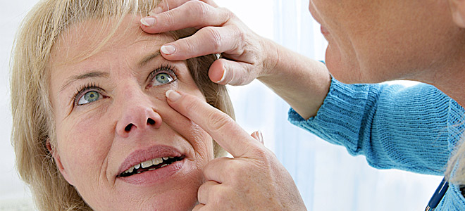 Πρόκειται για μία οφθαλμοπάθεια που οφείλεται σε έντονη έκθεση στο ήλιο χωρίς προστασία του ματιού.