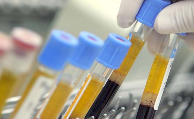 Νέος Κορωνοϊός - Γιατί Πρέπει να Ανησυχούμε Πολύ.