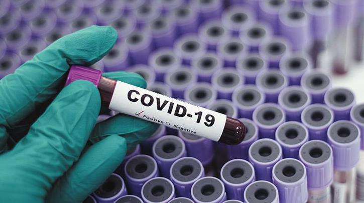 Οι ερευνητές αξιολόγησαν τα αποτελέσματα από 72.060 διαγνωστικά τεστ για τον SARS-CoV-2. Οι ερευνητές αξιολόγησαν τα αποτελέσματα από 72.060 διαγνωστικά τεστ για τον SARS-CoV-2.