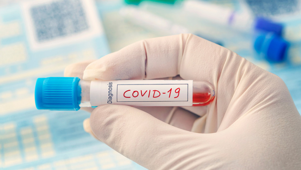 Νέα Θεραπευτική Προσέγγιση για τη Νόσο COVID-19.