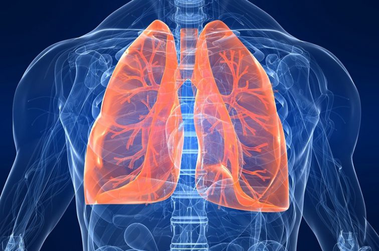 Ένας στους 100 Νοσηλευόμενους Ασθενείς με COVID-19 Εμφανίζει Πνευμοθώρακα ως Επιπλοκή.