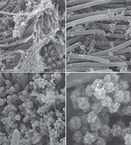 Εικόνες του SARS-CoV-2 να Προσβάλλει τα Κύτταρα του Αναπνευστικού.