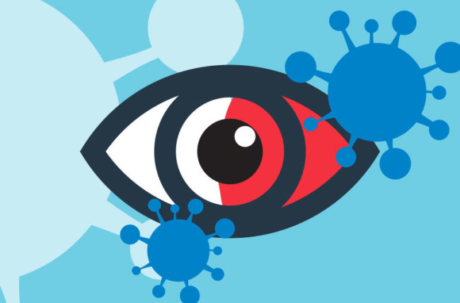 Η Σοβαρή Covid-19 Συνδέεται με Δυνητικά Επικίνδυνες Ανωμαλίες στα Μάτια Μερικών Ασθενών.