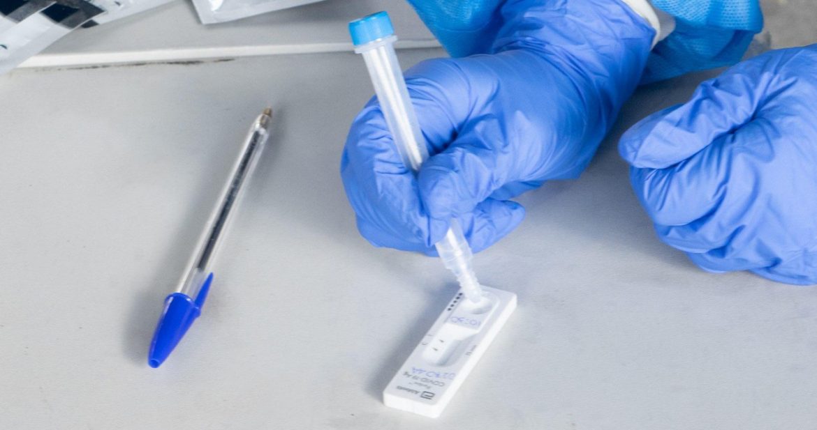 Υποχρεωτική η Διεξαγωγή 2 Rapid Test την Εβδομάδα σε Όλο το Προσωπικό του ΕΣΥ.