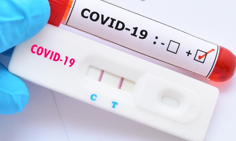 Έγκριση Rapid Test για Έλεγχο Ασυμπτωματικών Φορέων COVID-19.