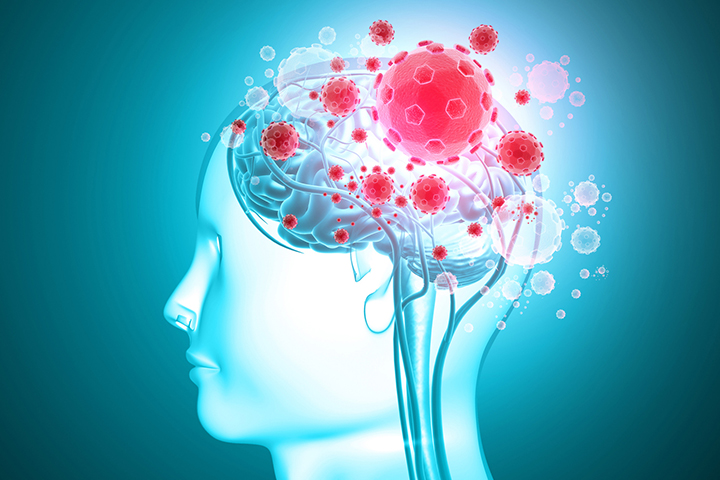 Η Covid-19 σε Συνδυασμό με Αιμορραγικό Εγκεφαλικό Υπερδιπλασιάζει τον Κίνδυνο Θανάτου.