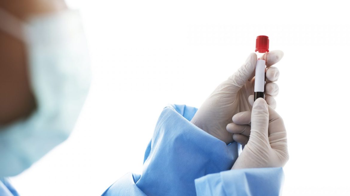 Η Λάθος Αξιολόγηση των Τεστ Αντισωμάτων Μπορεί να Οδηγήσει στη μη Σωστή Εκτίμηση της Ανοσίας Έναντι του SARS-CoV-2.