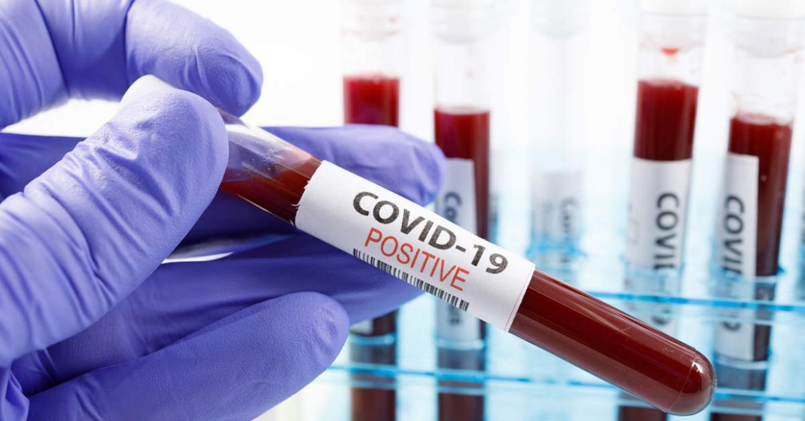 Άτομα Ομάδας Αίματος Ο Έχουν Μικρό Κίνδυνο Λοίμωξης COVID-19