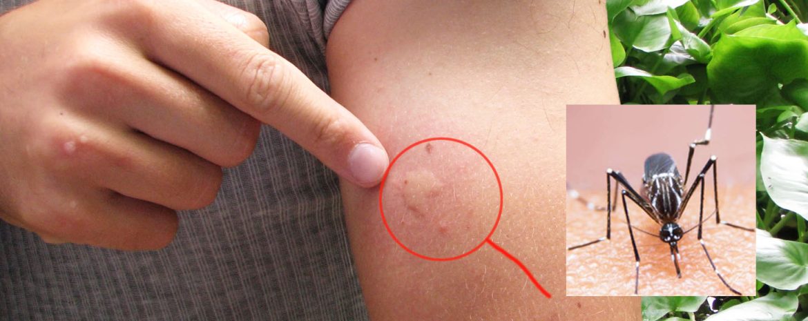 Αύξηση Ασθενειών από Τσίμπημα Κουνουπιών στην Ευρώπη