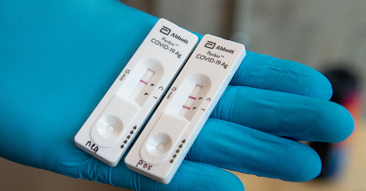 Διενέργεια των Rapid Tests Μόνο από Γιατρούς Ζητούν οι Ιατρικοί Σύλλογοι ΑΜΘ