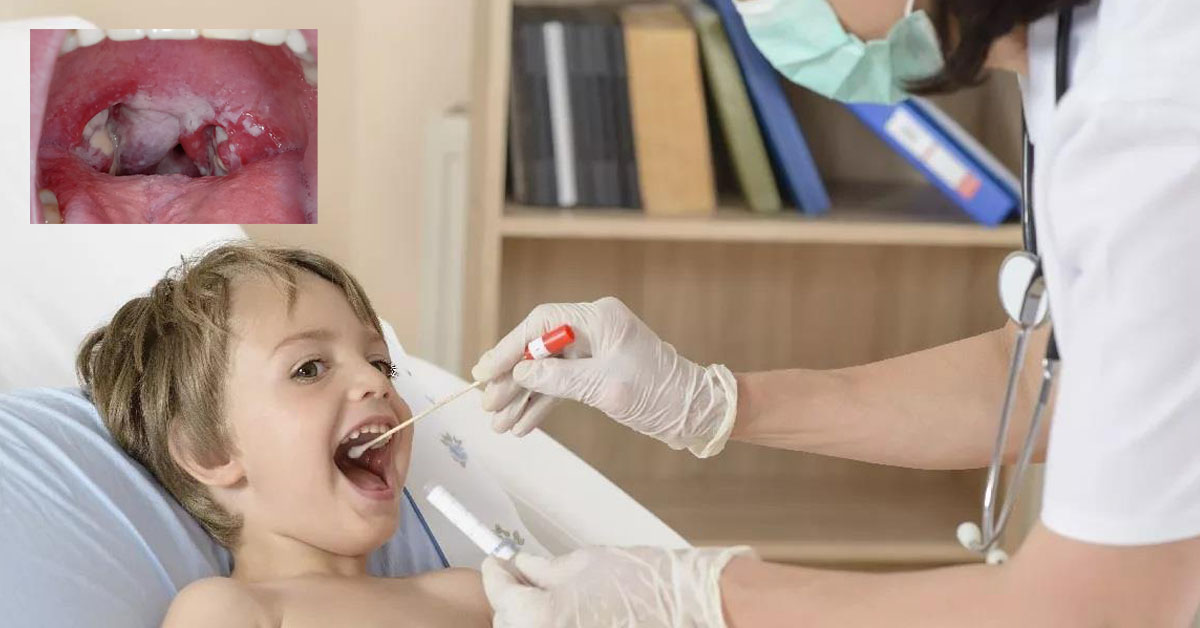 Στρεπτόκοκκος: Διάγνωση και τι Πρέπει να Προσέχουν οι Γονείς; Στρεπτόκοκκος: Διάγνωση και τι Πρέπει να Προσέχουν οι Γονείς;