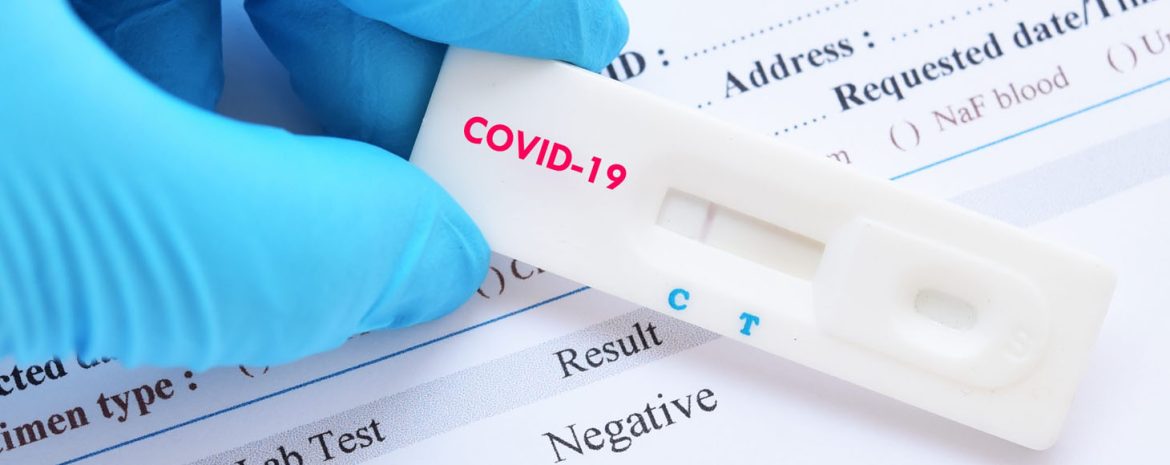 Διενέργεια των Rapid Tests Μόνο από Γιατρούς Ζητούν οι Ιατρικοί Σύλλογοι ΑΜΘ