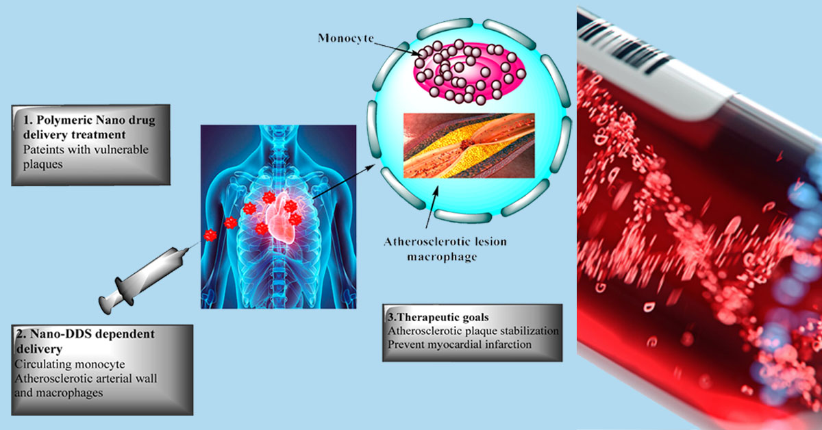 Νέα Συσκευή Νανοσωματιδίων Διάγνωσης Εμφράγματος και Νανοφάρμακα για Καρκινοπαθείς Νέα Συσκευή Νανοσωματιδίων Διάγνωσης Εμφράγματος και Νανοφάρμακα για Καρκινοπαθείς