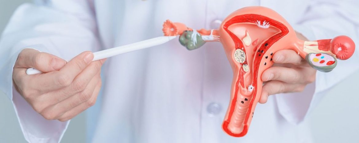 Κομμώτριες, Αισθητικοί και Λογίστριες με Αυξημένο Καρκίνο των Ωοθηκών