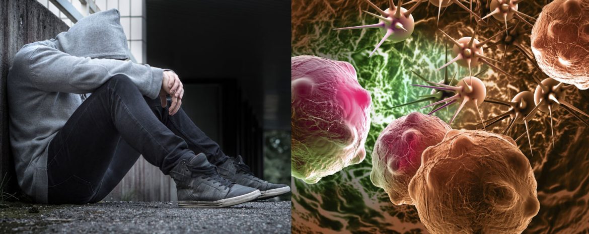 Κατάθλιψη, Άγχος Καρκίνος: Πραγματική ή Πλασματική Συσχέτιση;