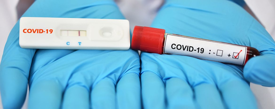 Εξετάσεις Αίματος Μπορούν να Προσδιορίσουν με Ακρίβεια Ασθενείς με Long Covid