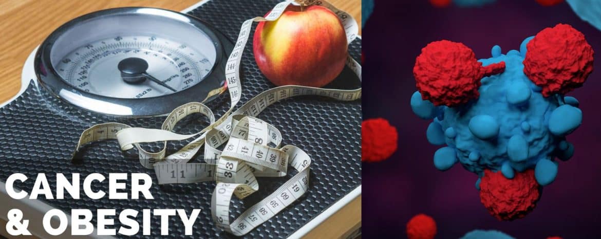 Ιατροί της Ιατρικής Σχολής ΕΚΠΑ συνοψίζουν δεδομένα συσχετισμού δείκτη μάζας σώματος ενηλίκων καρδιομεταβολικών νοσημάτων και κινδύνου εμφάνισης καρκίνου