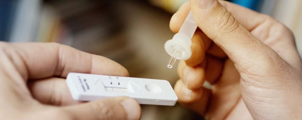 Τα γρήγορα τεστ αντιγόνου για σοβαρό οξύ αναπνευστικό σύνδρομο κορονοϊού (SARS-CoV-2) είναι αποτελεσματικά εργαλεία για τη διάγνωση της οξείας λοίμωξης