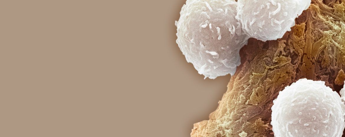 Τα αιμοποιητικά βλαστικά κύτταρα καθώς μεγαλώνουμε ευνοούν την παραγωγή των μυελοειδών κυττάρων