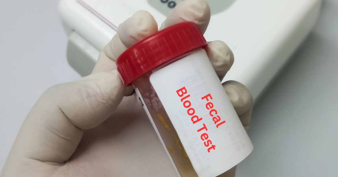 Ένταση μεταξύ Φ.Σ. Αττικής και Πανελληνίου για τα τεστ παχέος εντέρου