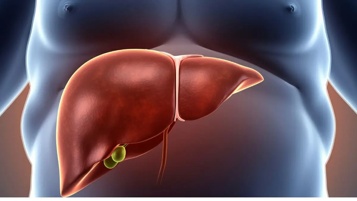 Διπλάσια θνησιμότητα σε άτομα με λιπώδες ήπαρ σε σχέση με το γενικό πληθυσμό