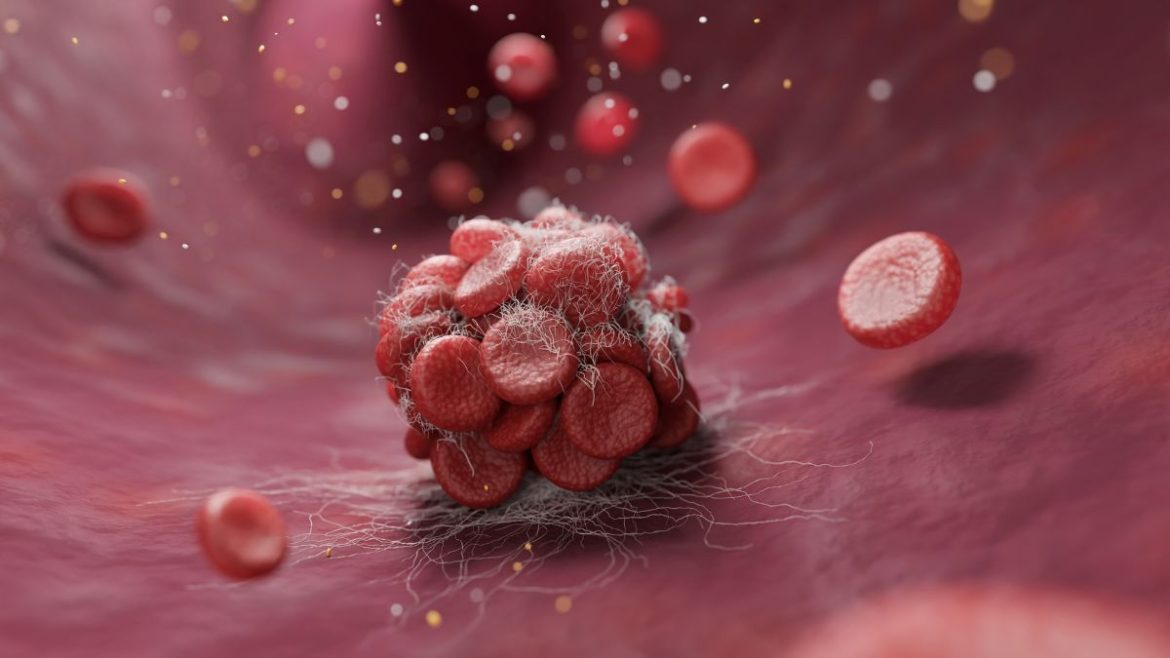 Pharma Article Covers – 2025-06-06T103900.315 Θρόμβοι