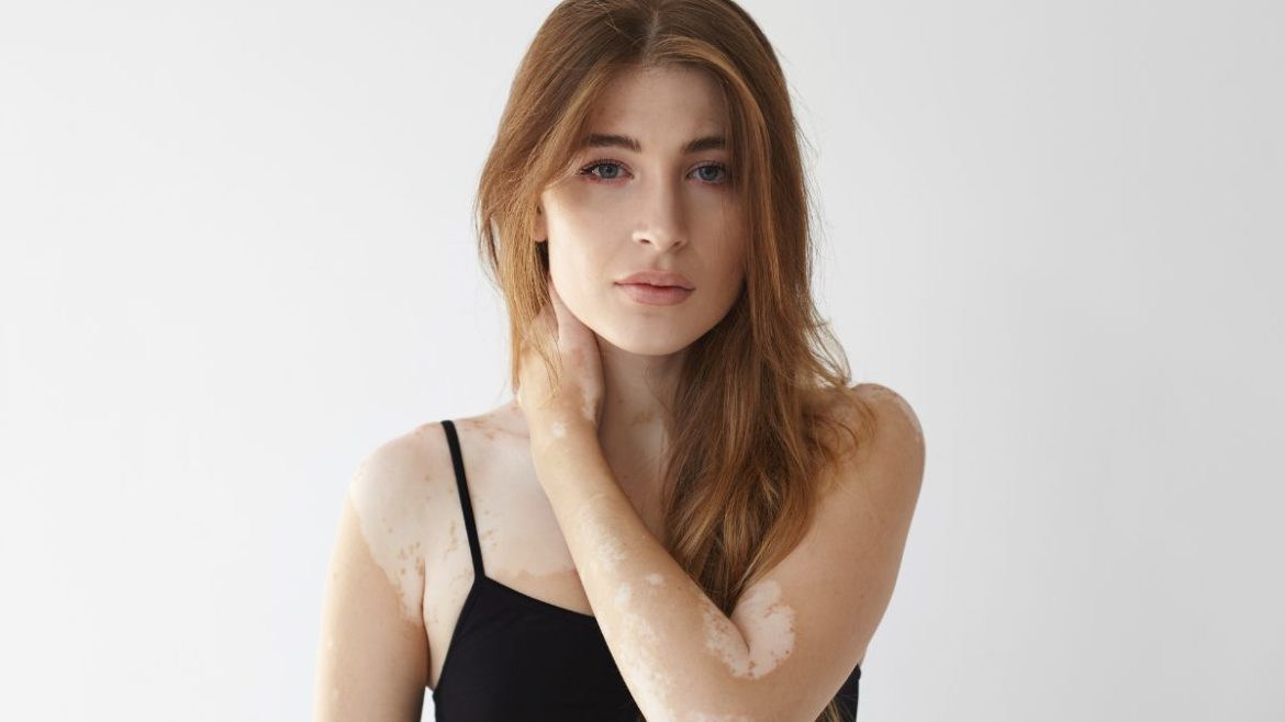 Χρόνια φλεγμονή αυτοάνοσα νοσήματα