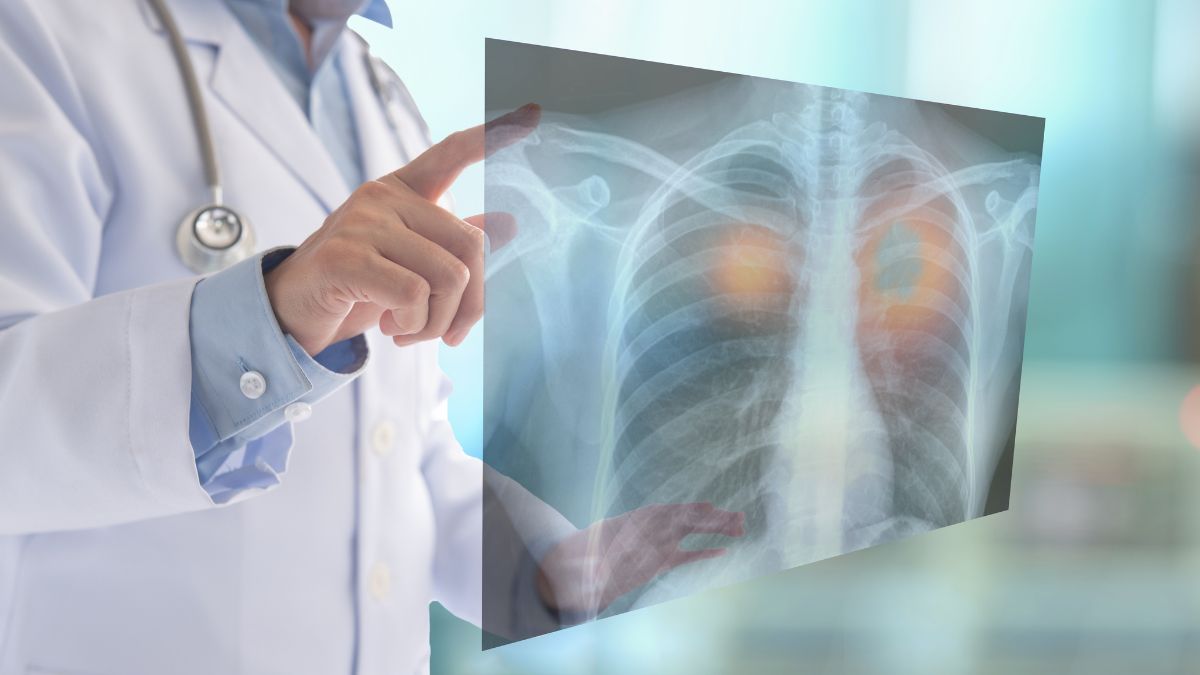 διακοπή καπνίσματος μετά τη διάγνωση καρκίνου